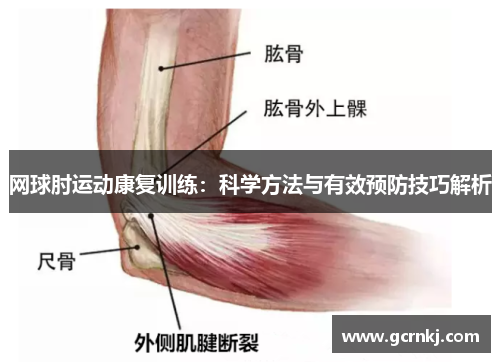 网球肘运动康复训练：科学方法与有效预防技巧解析